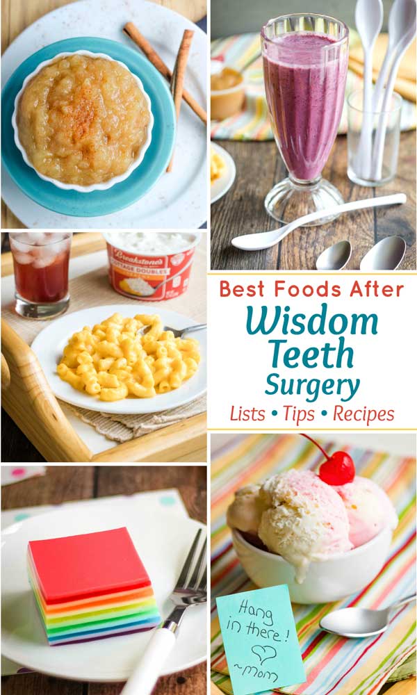 collage of food and recipe ideas with the text overlay "Best Foods After Wisdom Teeth Surgery (Lists, Tips, Recipes)"